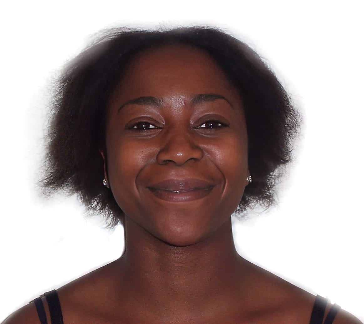 Before Picture - Traction Alopecia from Clip-In Hairpiece